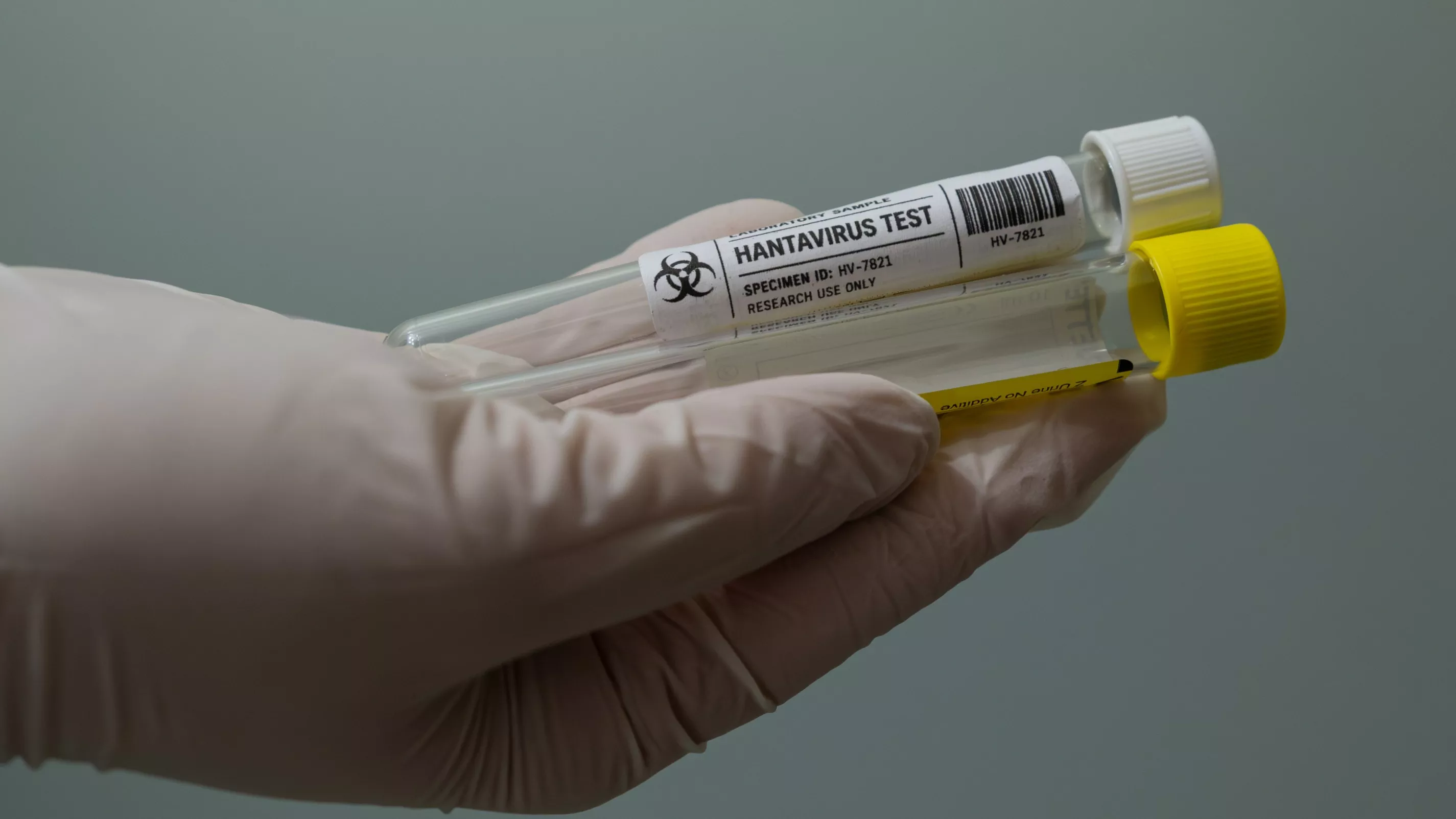 Hantavirus: a tourist who passed through France tested positive