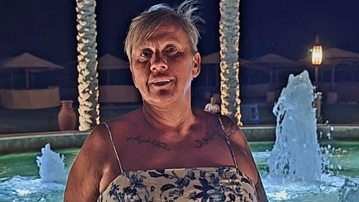 Welsh beachgoers suffer awful burns after using disposable barbecues on the sand
