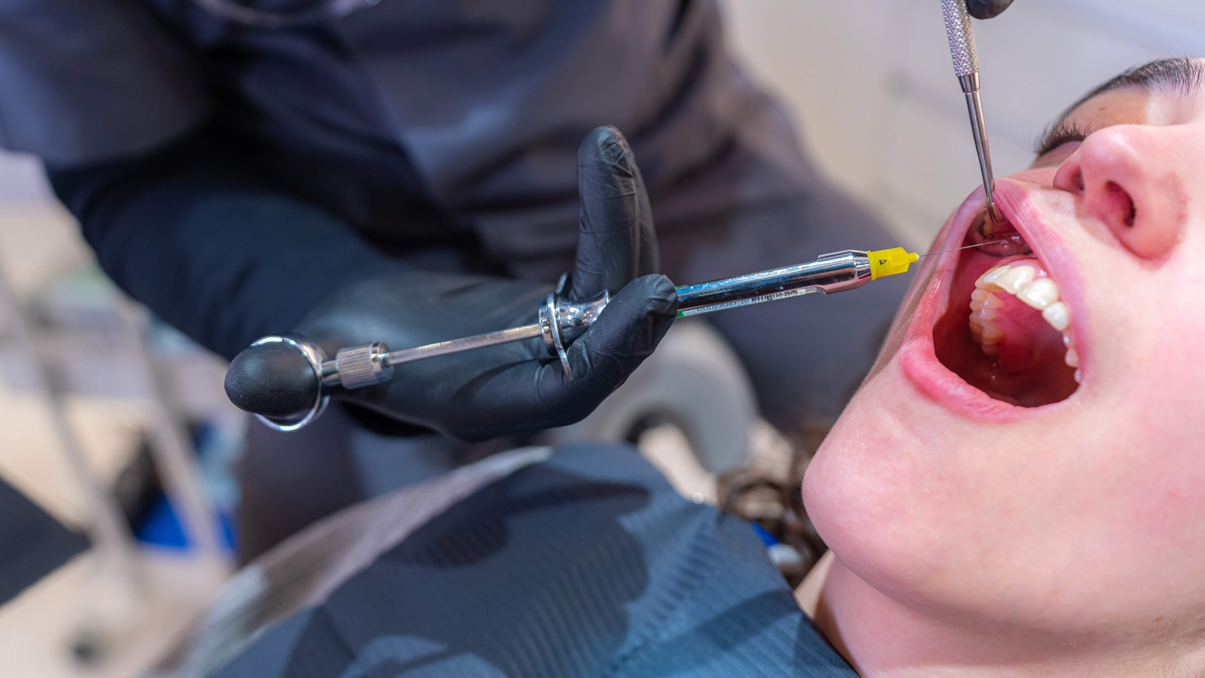 Louise, 17, comes for ankle surgery, but wakes up without wisdom teeth.