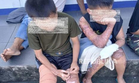 It Has Been One Year But There Are No Suspects in the Case of 3 Lombok Students Burned Alive.