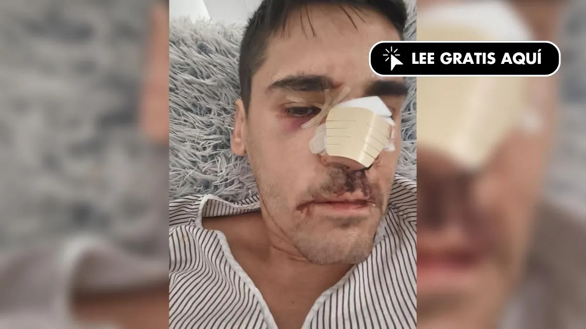 Journalist Fonsi Loaiza reports a beating on the street: "They called me 'red, runner-up'"