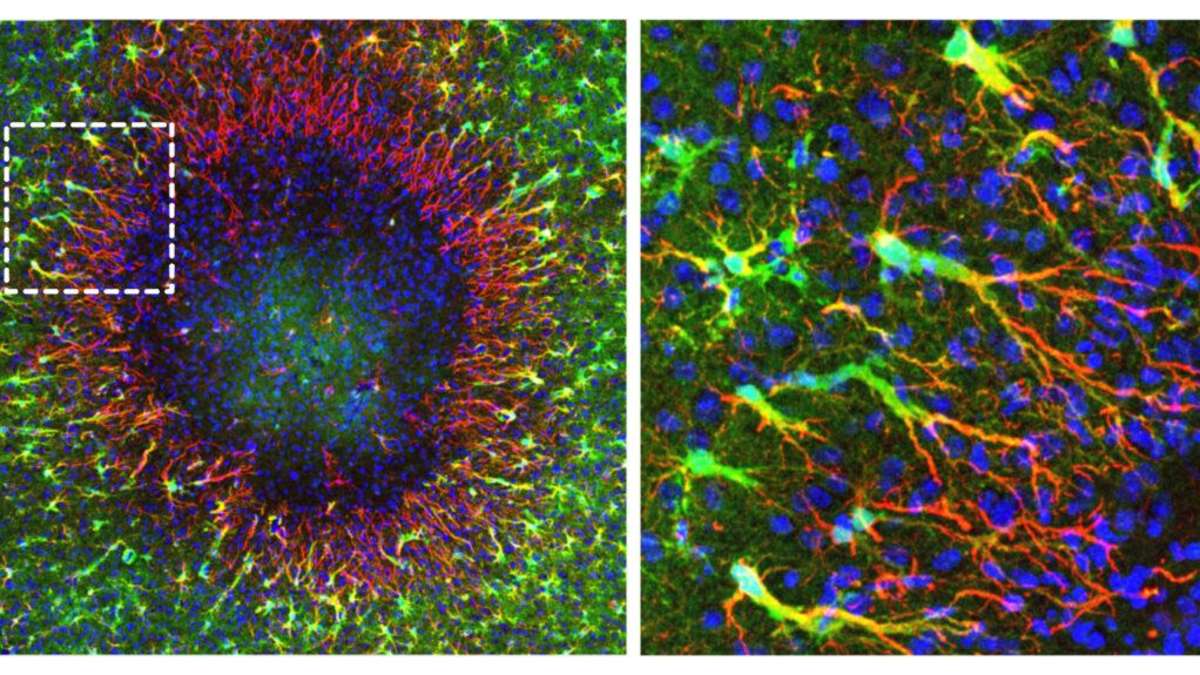 Our brain has a previously unknown form of self-healing